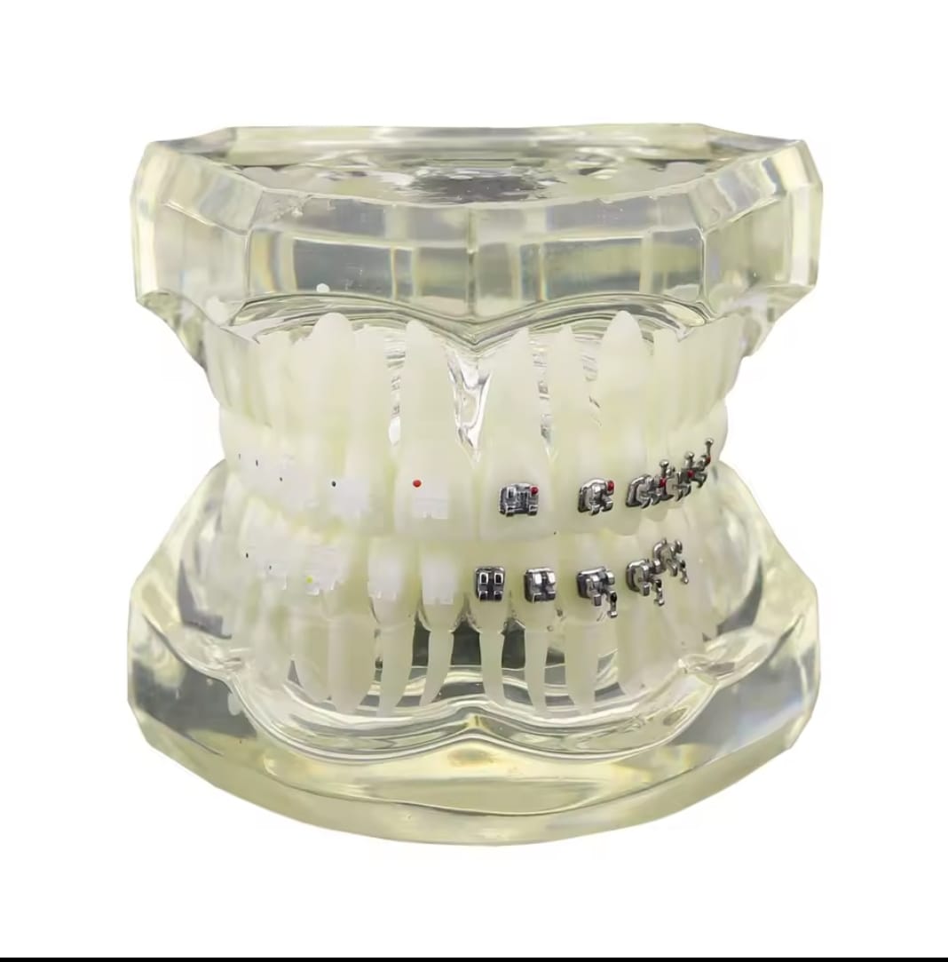 Typodont Orthodontics