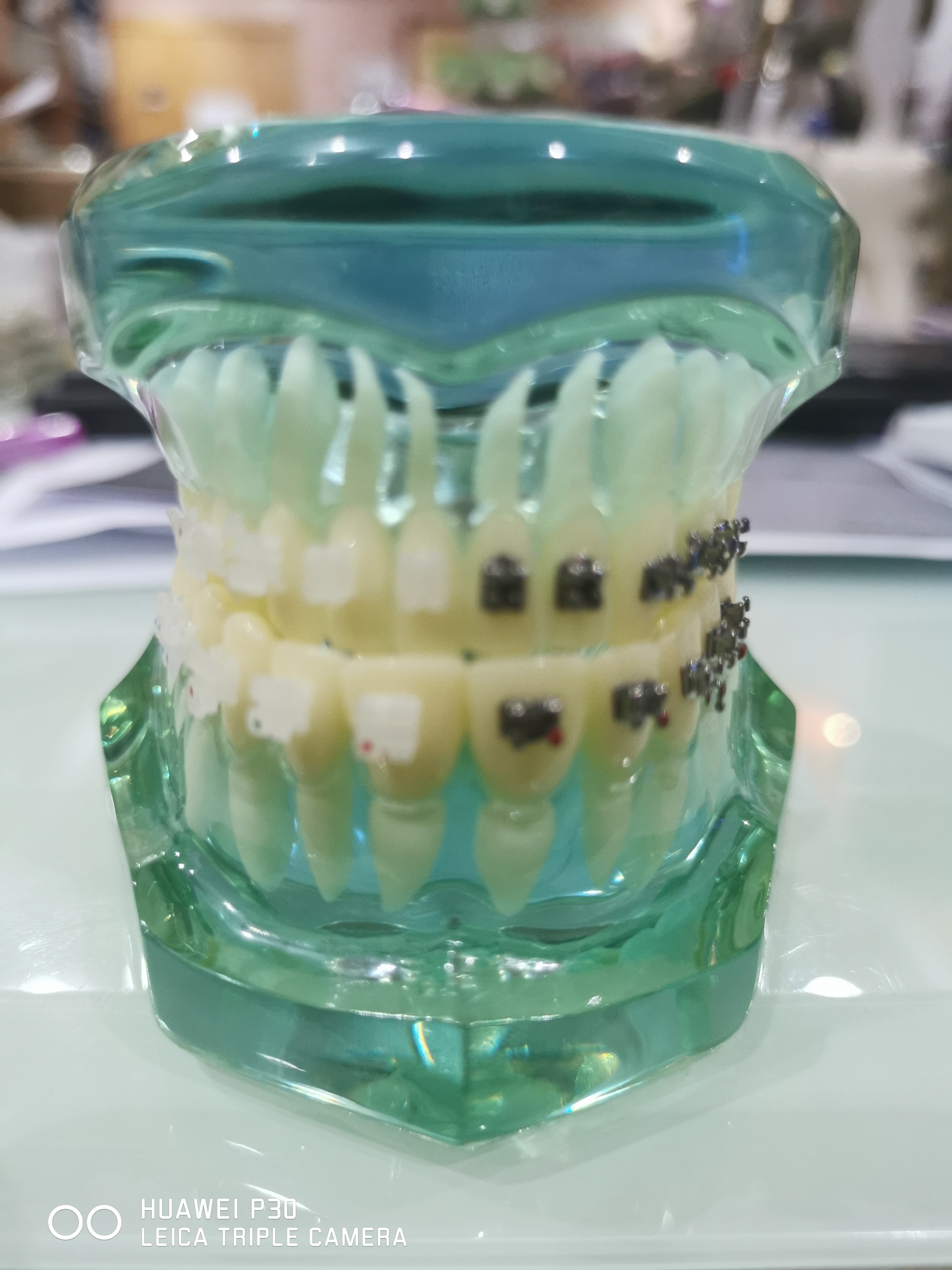 Typodont Orthodontics