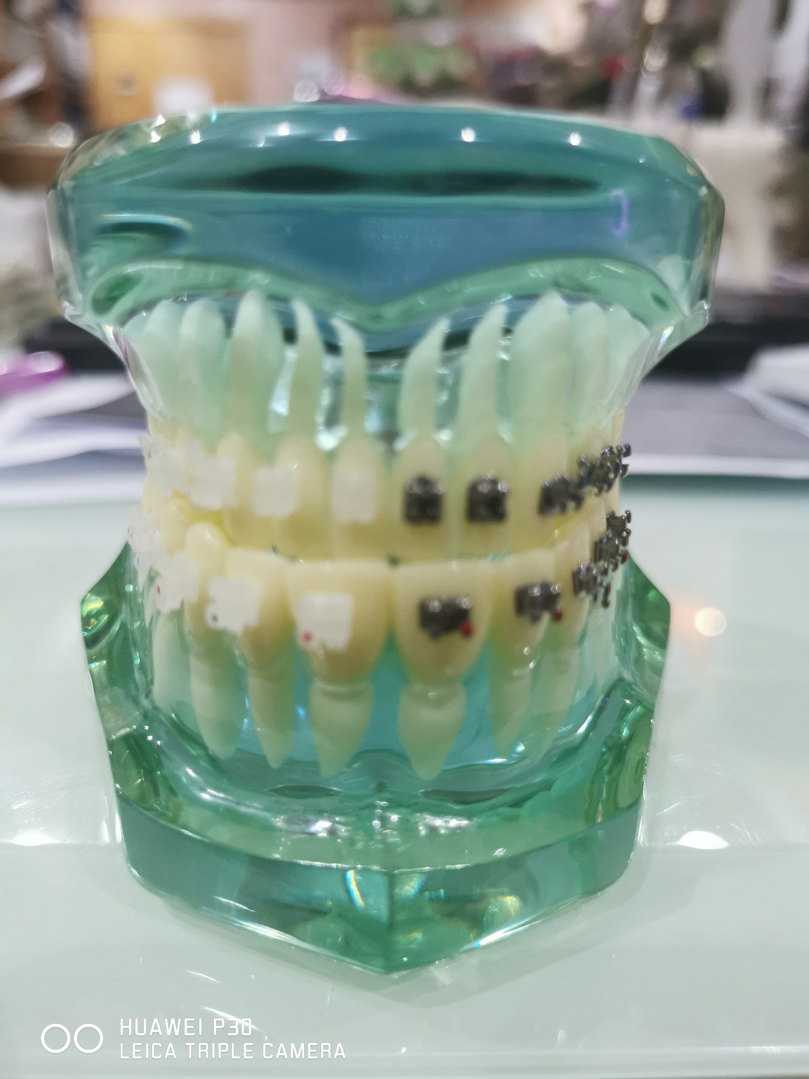 Typodont Orthodontics