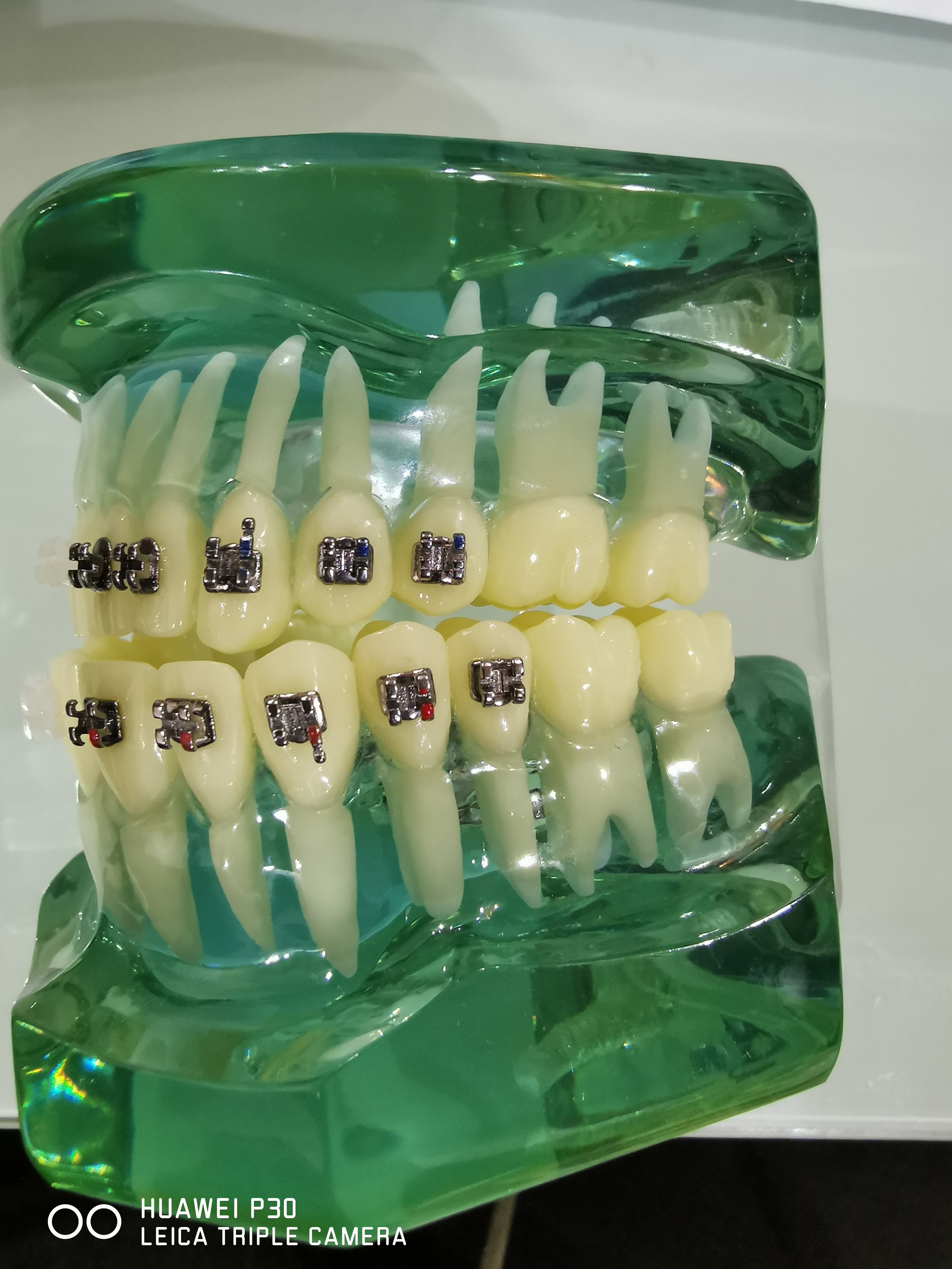 Typodont Orthodontics