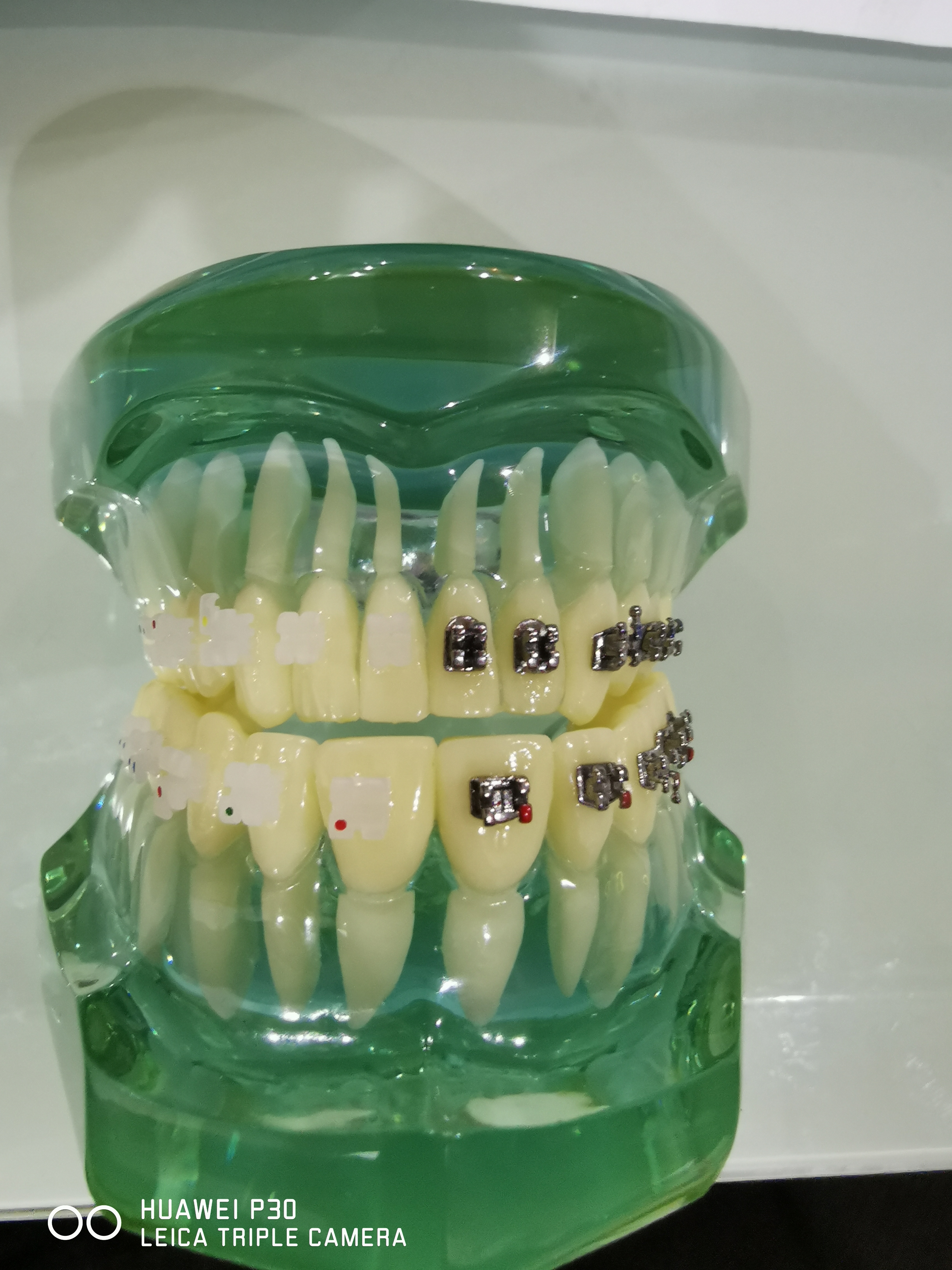 Typodont Orthodontics