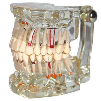 Dental Model Full Mouth Dental